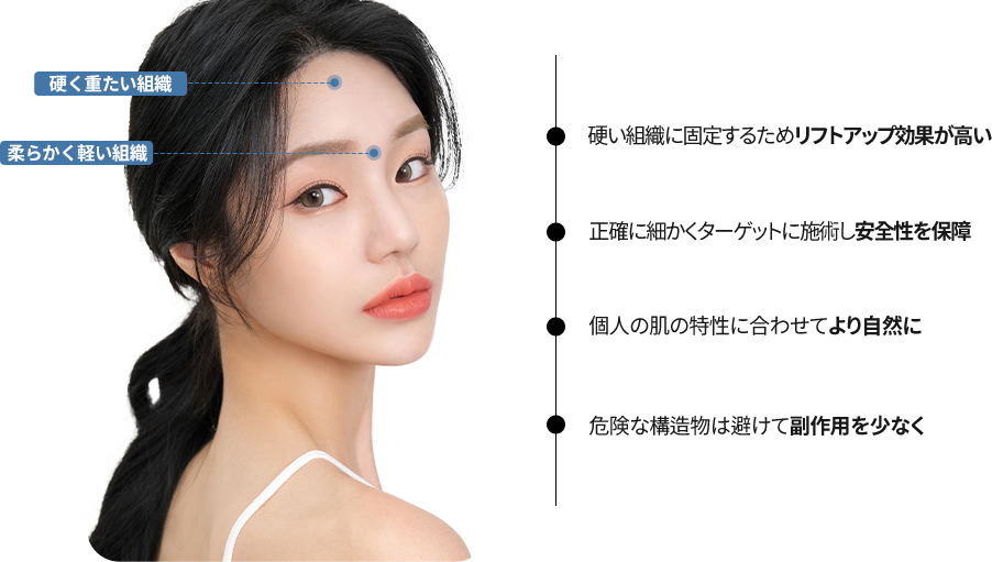 눈썹거상리프팅